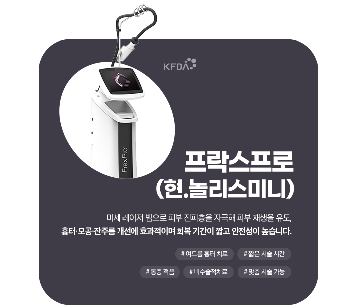 프락스프로(현.놀리스미니)