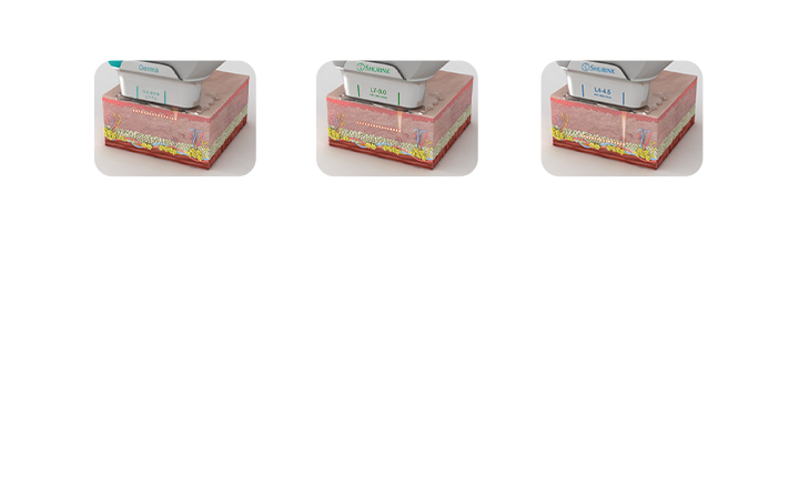 콜라겐의 수축과 촉진 효과 기대