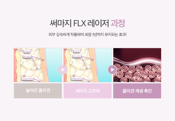 써마지 FLX 과정