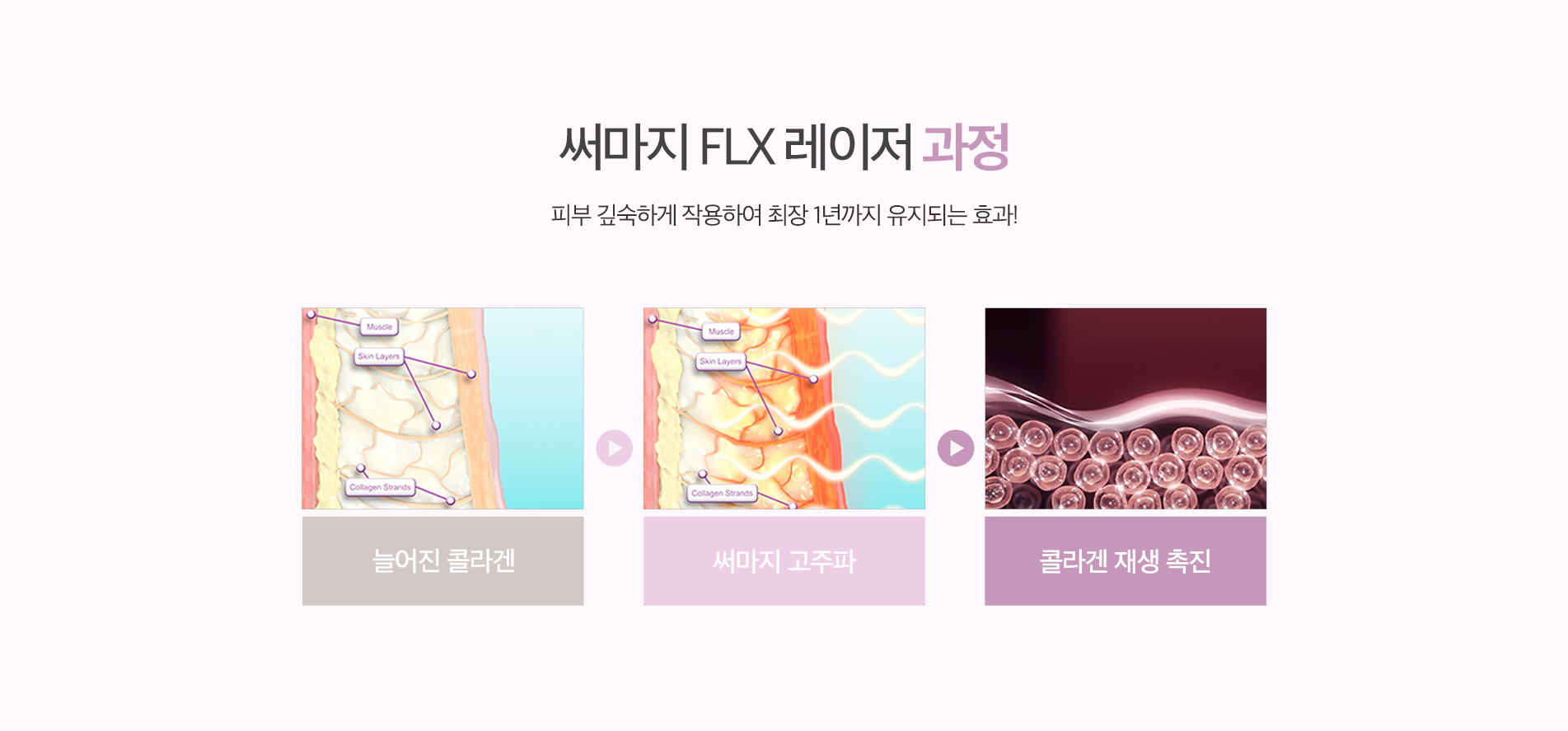 써마지 FLX 과정